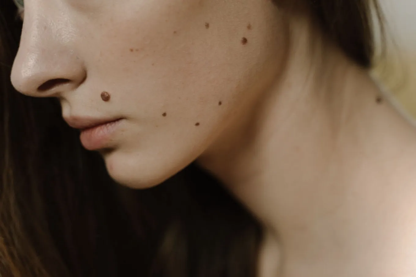 Close do rosto e do pescoço de uma mulher com várias pintas escuras pequenas